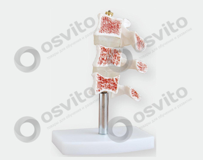 %d0%9e%d1%81%d1%82%d0%b5%d0%be%d0%bf%d0%be%d1%80%d0%be%d0%b7-%d0%b2-%d1%80%d0%b0%d0%b7%d1%80%d0%b5%d0%b7%d0%b5-osvito